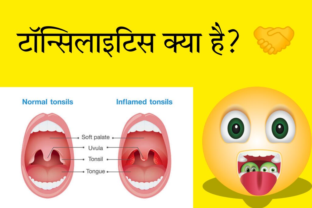 स्वस्थ गला, स्वस्थ जीवन: टॉन्सिलाइटिस के लिए योग और घरेलू उपाय